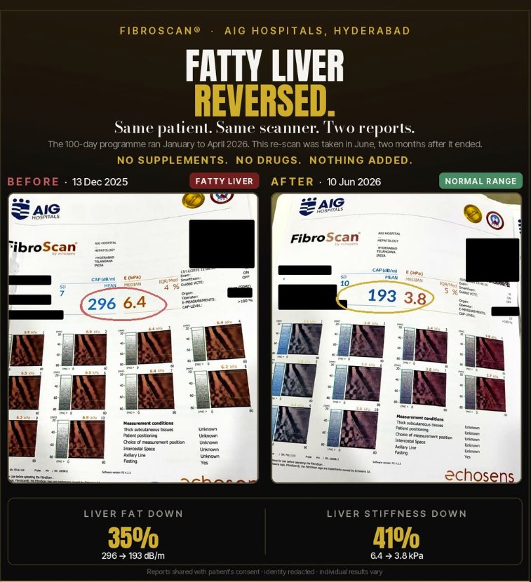 Two FibroScan reports from AIG Hospitals, Hyderabad, showing liver fat down from 296 to 193 dB per metre and liver stiffness down from 6.4 to 3.8 kPa